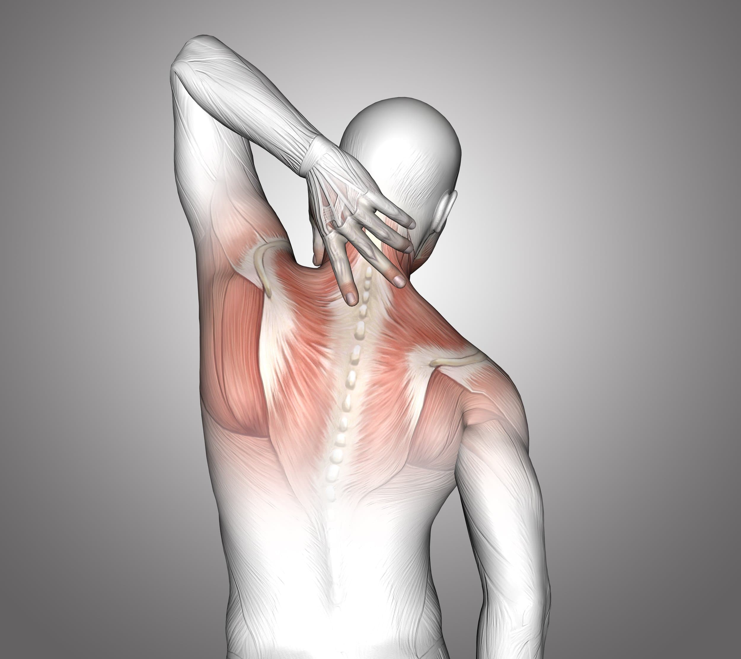 Musculoskeletal